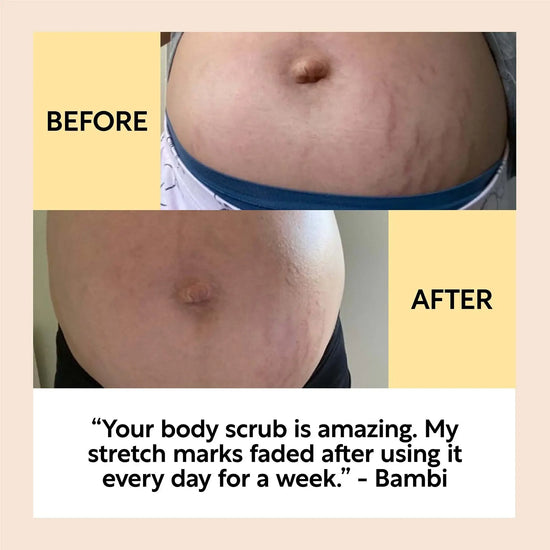 
                    
                      BodyScrubBeforeandAfterComplexion_2b9a7038-d37e-43b7-8c92-7d00adae4162 - Miracle Tree
                    
                  